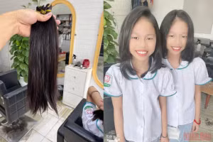Lọn tóc buộc chun vàng - món quà đặc biệt của cặp đôi song sinh gửi tặng các bạn nhỏ đang mắc căn bệnh ung thư quái ác. (Ảnh: Gia đình cung cấp)