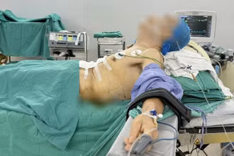 Tư thế nửa nằm nửa ngồi của bệnh nhân trong phòng phẫu thuật.