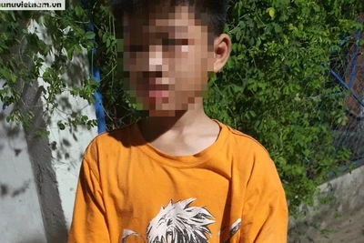 Bé H.A bị cha ruột đánh (Ảnh: Báo Phụ nữ Việt Nam)