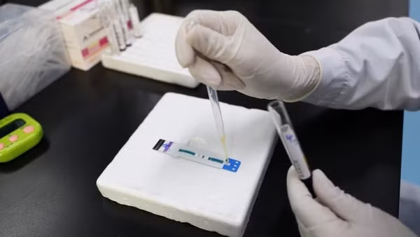 Bác sĩ xét nghiệm mẫu bệnh phẩm để phát hiện HIV/AIDS tại Bệnh viện Nhân dân số 4 Nam Ninh, thành phố Nam Ninh, Khu tự trị dân tộc Choang Quảng Tây, Trung Quốc, ngày 21/11/2024. (Ảnh: Tân Hoa Xã)