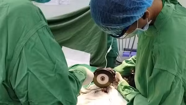 Các bác sĩ dùng cưa phẫu thuật cho bệnh nhân.