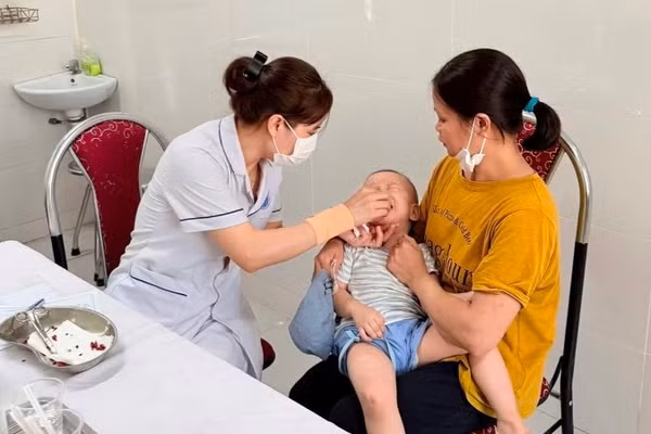 Cho trẻ uống Vitamine A tại tuyến y tế cơ sở.