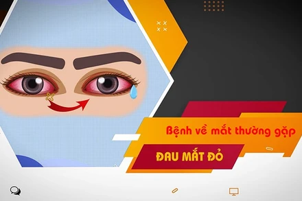[Video] Chủ động phòng, chống bệnh đau mắt đỏ trong mùa mưa