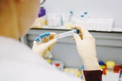 Việc chuẩn hóa và quản lý chất lượng xét nghiệm giúp giảm chi phí, thời gian chờ đợi cho người bệnh.