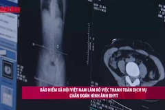 [Video] Bảo hiểm xã hội Việt Nam làm rõ việc thanh toán dịch vụ chẩn đoán hình ảnh BHYT