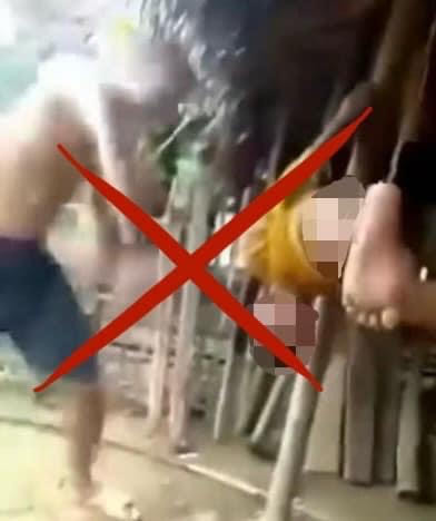 Hình ảnh cháu Q bị cha dượng bạo hành.