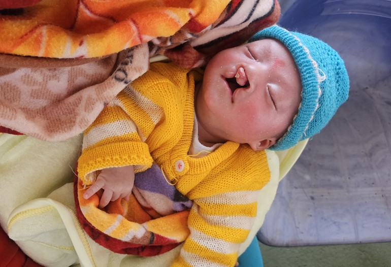 Một số ca bệnh đặc biệt như dị tật chân tay, hàm mặt, bệnh hiếm khó chữa sẽ được Quỹ Nâng bước tuổi thơ thành phố Hồ Chí Minh phối hợp Quỹ Từ Tâm Đắk Lắk xem xét, tài trợ đưa xuống điều trị tại các Bệnh viện chuyên khoa đầu ngành ở thành phố Hồ Chí Minh.