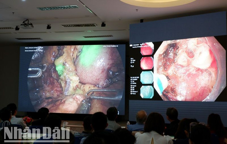 Hội nghị Câu lạc bộ Ung thư dạ dày thế giới là diễn đàn khoa học uy tín cho các chuyên gia, bác sĩ của Việt Nam cũng như trên thế giới.