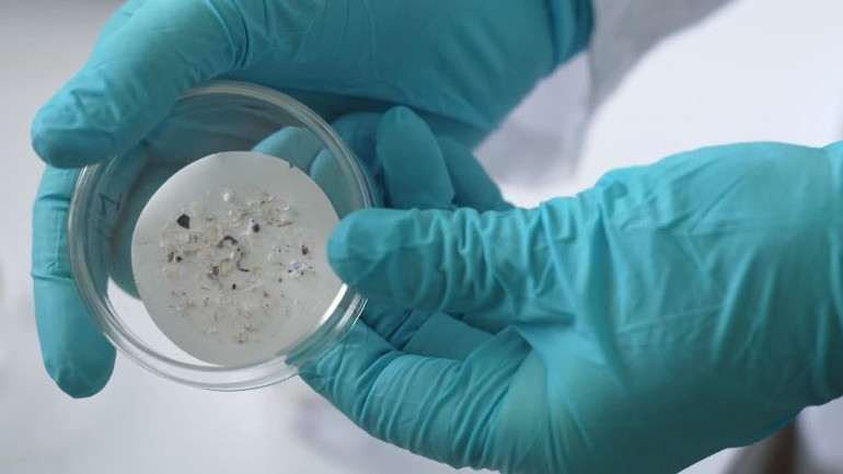 Những hạt vi sợi nhựa được tìm thấy trong các cá thể hàu ở vùng biển ô nhiễm nhựa. (Ảnh: FranceInfo) Những hạt vi sợi nhựa được tìm thấy trong các cá thể hàu ở vùng biển ô nhiễm nhựa. (Ảnh: FranceInfo)