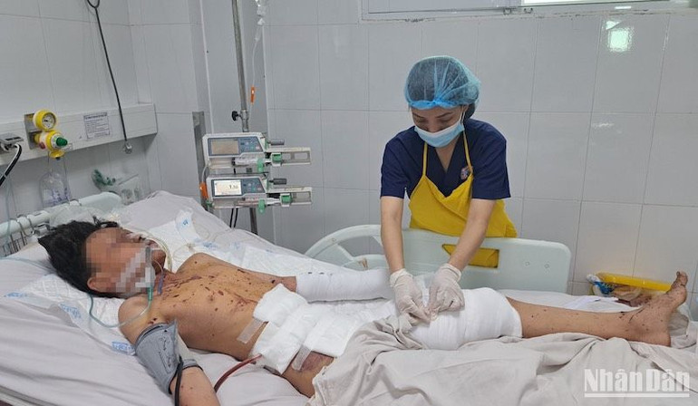 Bệnh nhân Đ.H.P, (sinh năm 2012, trú quận Sơn Trà, thành phố Đà Nẵng) đang được điều trị tích cực tại Bệnh viện Đà Nẵng. Ảnh: ANH ĐÀO