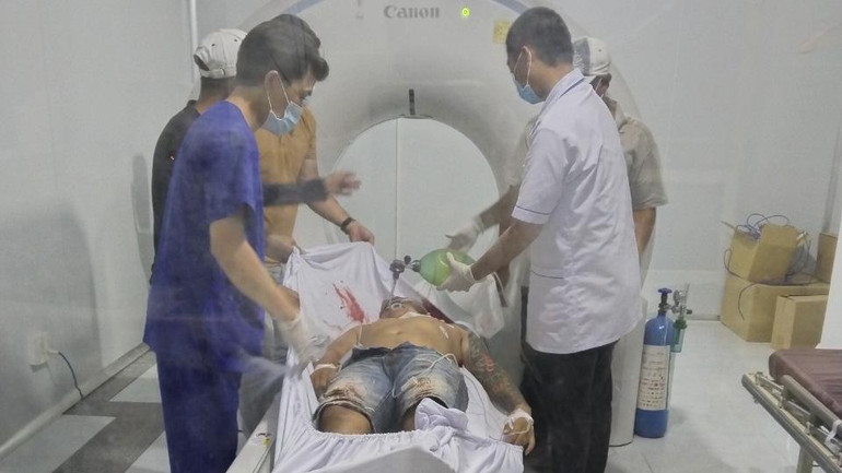 Một người được cấp cứu trong vụ nổ súng làm chết tại chỗ 2 người ở ấp Bến Tràm, xã Cửa Dương, thành phố Phú Quốc ngày 27/10.