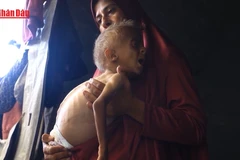 [Video] UNICEF báo động tình trạng trẻ em Dải Gaza suy dinh dưỡng nặng dù đã ngừng bắn 