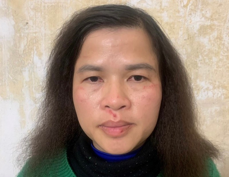 Đối tượng Nguyễn Thị Ái Liên.