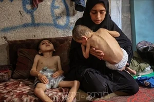 Trẻ em Gaza bị suy dinh dưỡng. (Ảnh: THX/TTXVN)