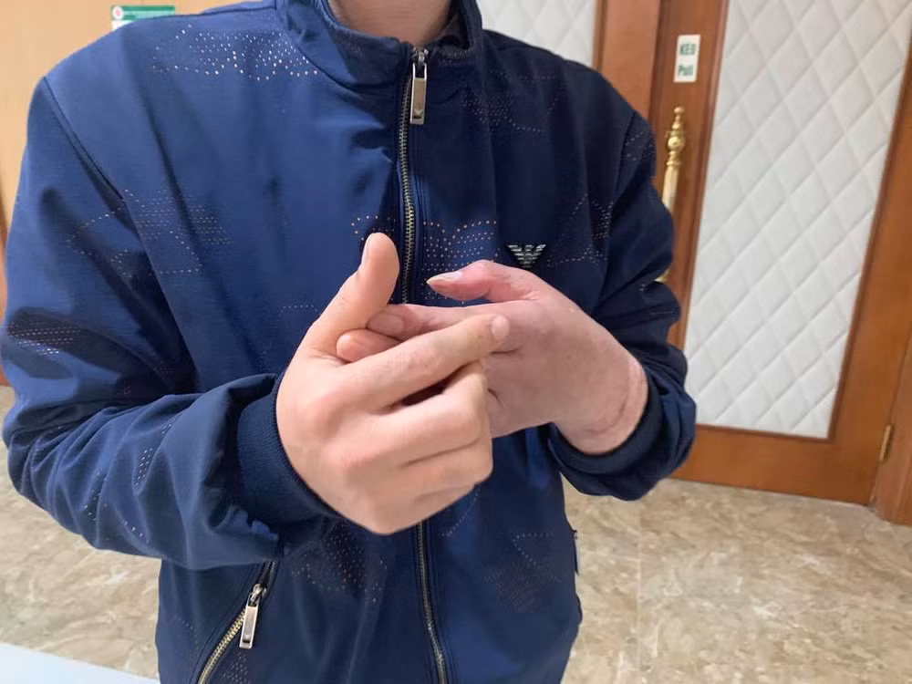 Cuộc sống mới của người đàn ông Việt Nam đầu tiên được ghép tay -0