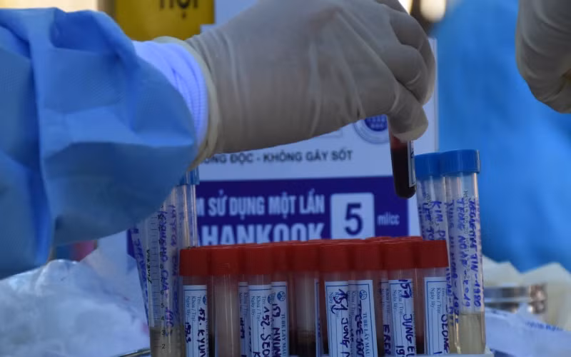 Đà Nẵng có ca tái dương tính với virus SARS-CoV-2 sau 18 ngày xuất viện. (Ảnh minh họa)