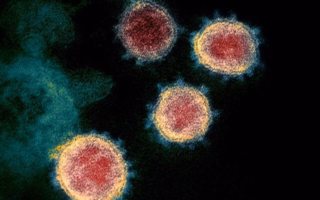 Virus SARS-CoV-2 qua kính hiển vi điện tử. Ảnh: NIAID.
