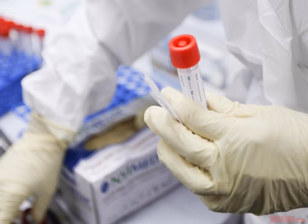 13vaccine_Vietnam_giai_doan_2-1614329247092.JPG