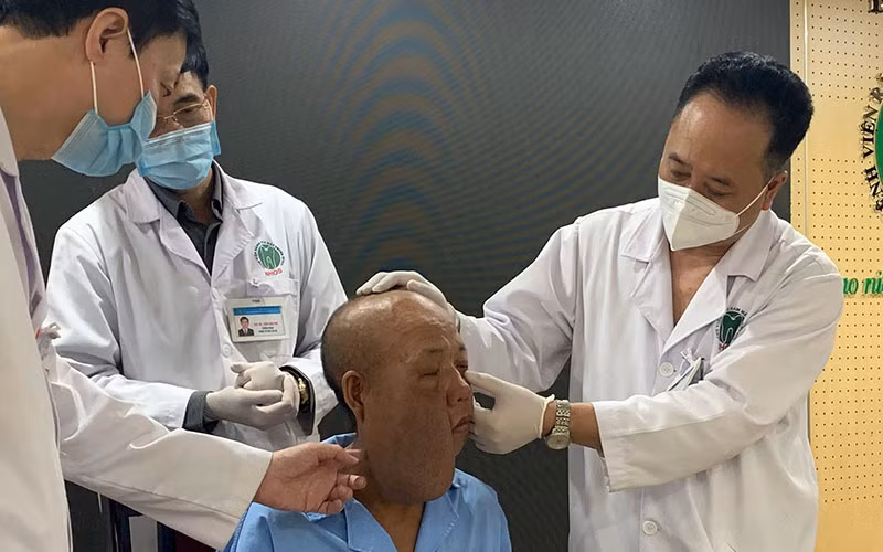 Phẫu thuật cho người đàn ông có khối u kỳ dị trên mặt -0