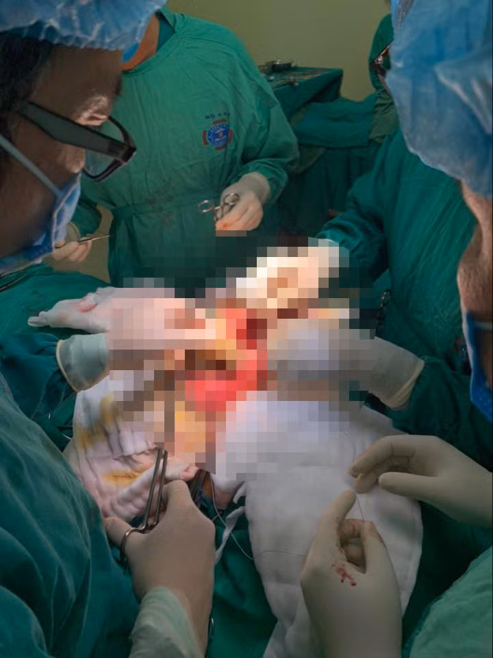 Lần đầu tiên thay xương bả vai cho bệnh nhi nhỏ tuổi nhất Việt Nam -0