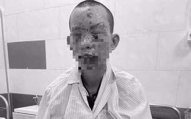 Bệnh nhân bị tổn thương mất thị lực.