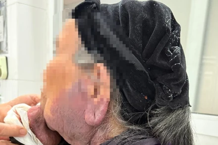 Các bác sĩ thăm khám cho người bệnh trước khi phẫu thuật