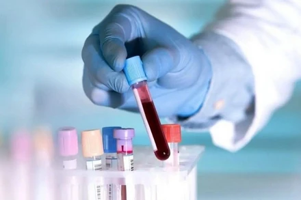 Dấu hiệu đặc trưng về bệnh sốt mò (trung gian truyền bệnh là ấu trùng bọ ve mò) có vết loét hình bầu dục. 