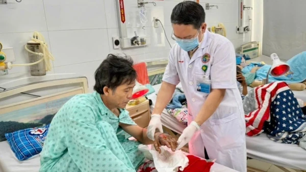 Bác sĩ kiểm tra bàn tay của bệnh nhân sau ca phẫu thuật nối chi phức tạp. 