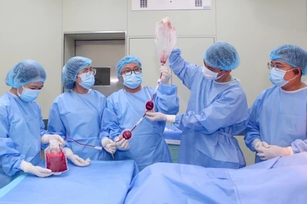 Ca ghép được thực hiện dưới sự hỗ trợ của chuyên gia trong và ngoài nước. (Ảnh: Bệnh viện Trung ương Huế cung cấp)