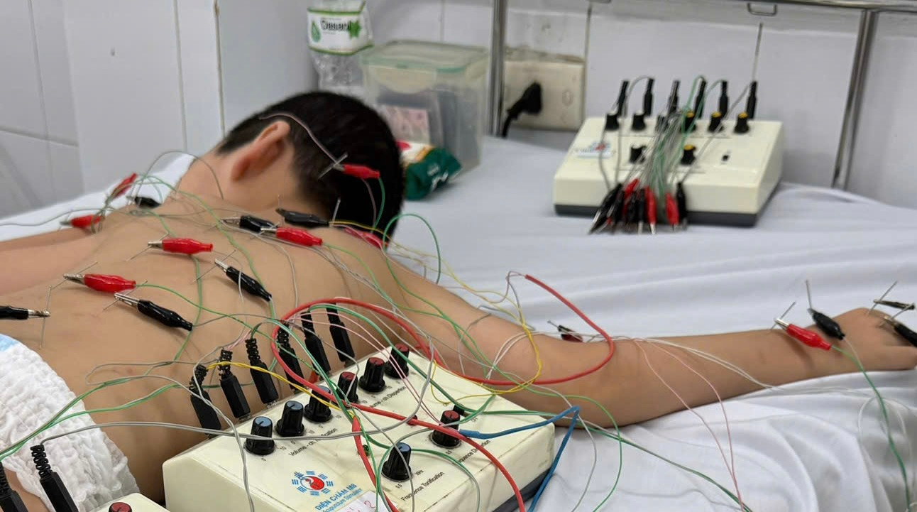 Các phương pháp kết hợp giữa y học cổ truyền và y học hiện đại nhằm hỗ trợ phục hồi chức năng cho trẻ.