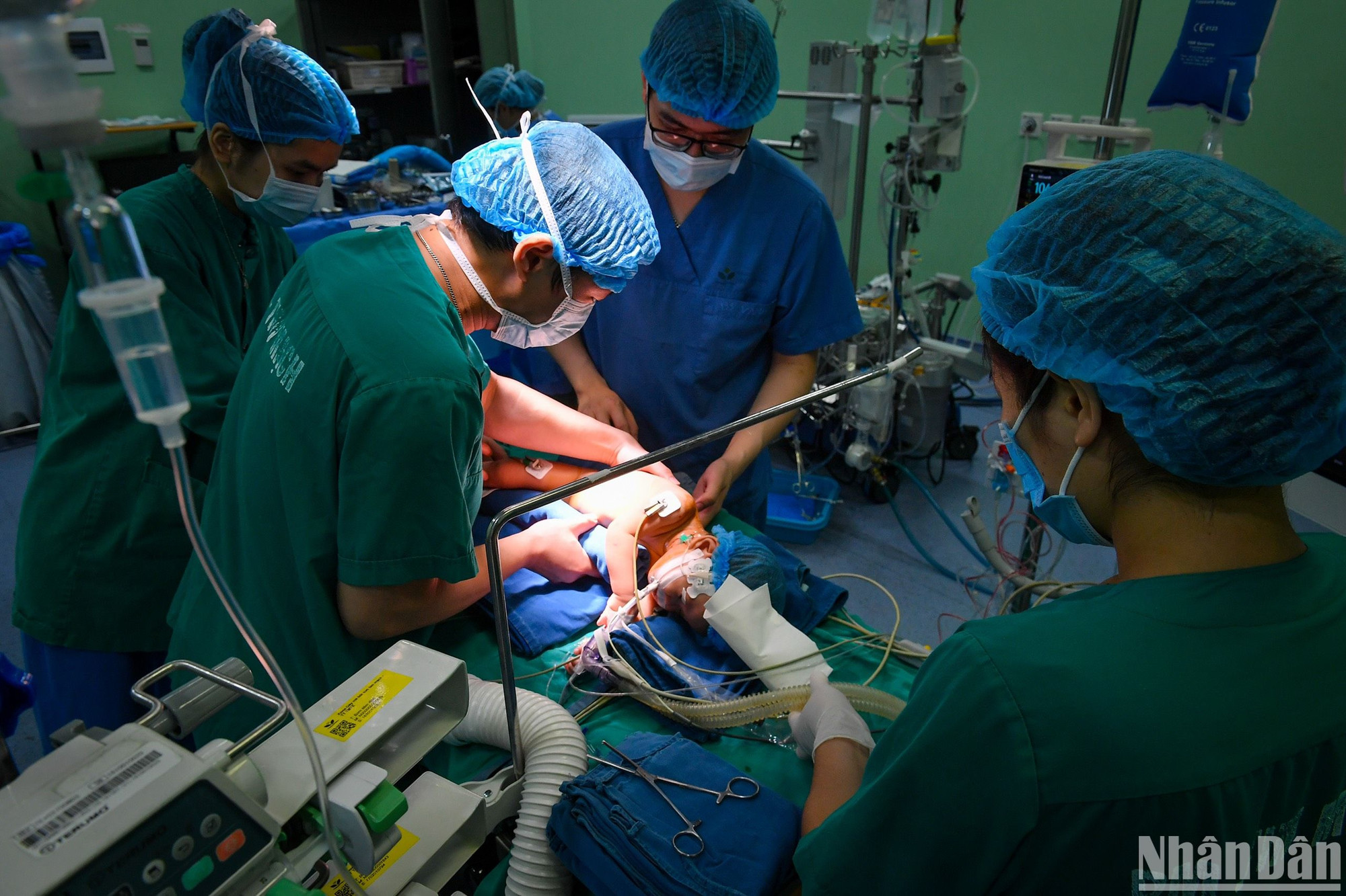 Bệnh nhi được phẫu thuật bằng kỹ thuật ít xâm lấn qua đường nách phải. Bệnh nhi được phẫu thuật bằng kỹ thuật ít xâm lấn qua đường nách phải.