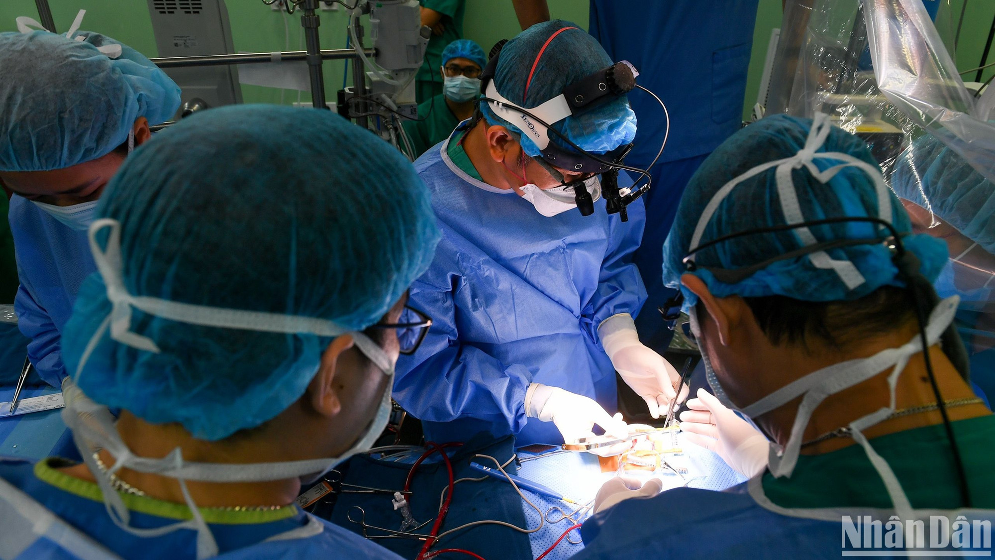 Ca phẫu thuật tim ít xâm lấn thứ 700 cho bệnh nhi mắc tứ chứng Fallot - một bệnh lý tim bẩm sinh. Ca phẫu thuật tim ít xâm lấn thứ 700 cho bệnh nhi mắc tứ chứng Fallot - một bệnh lý tim bẩm sinh.