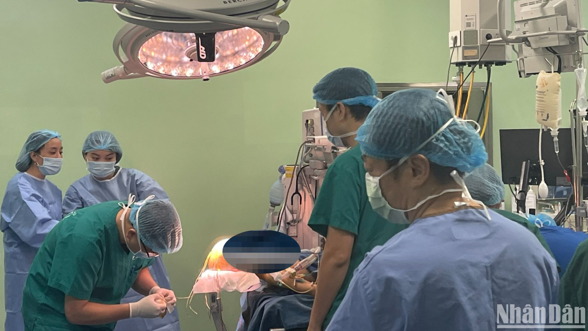 Chi phí cho một ca phẫu thuật động kinh rất tốn kém.