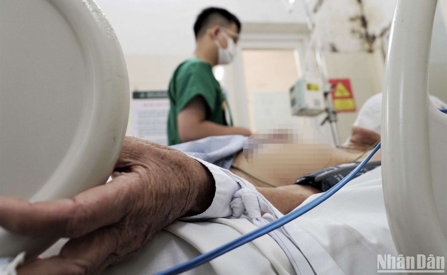 Trường hợp mắc sốt xuất huyết nặng nằm điều trị tại Bệnh viện Bạch Mai.