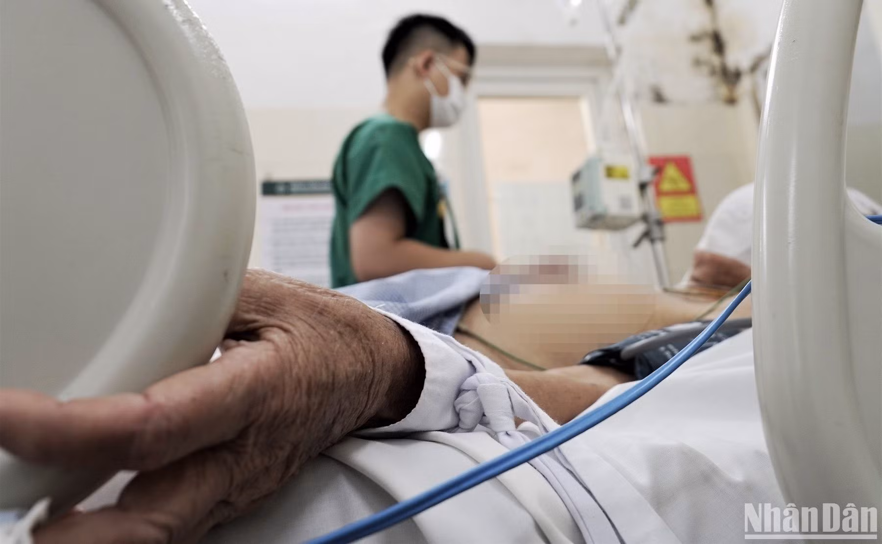 Trường hợp mắc sốt xuất huyết nặng nằm điều trị tại Bệnh viện Bạch Mai.