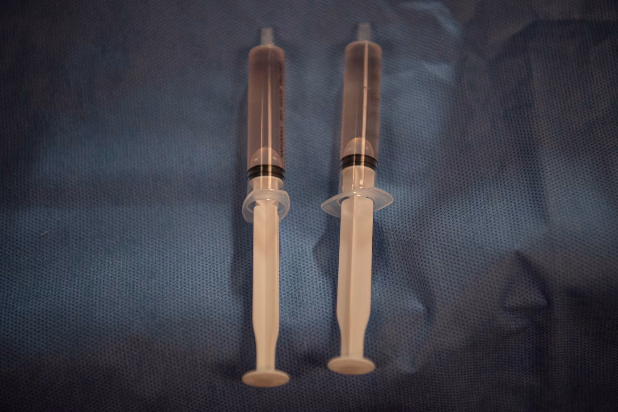 Kết quả xét nghiệm tế bào từ nước ối cho thấy bào thai mang đột biến gen ACE liên quan đến loạn sản thận.