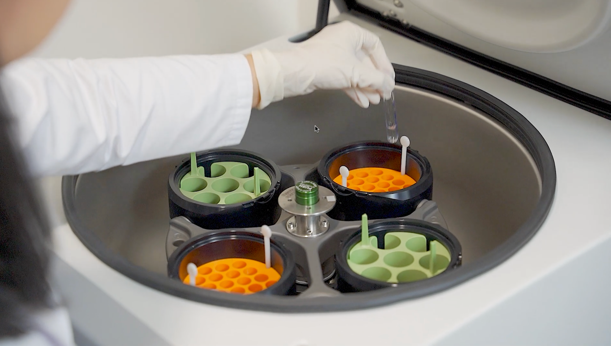 Chuẩn bị tế bào CAR-T để đánh giá chất lượng.