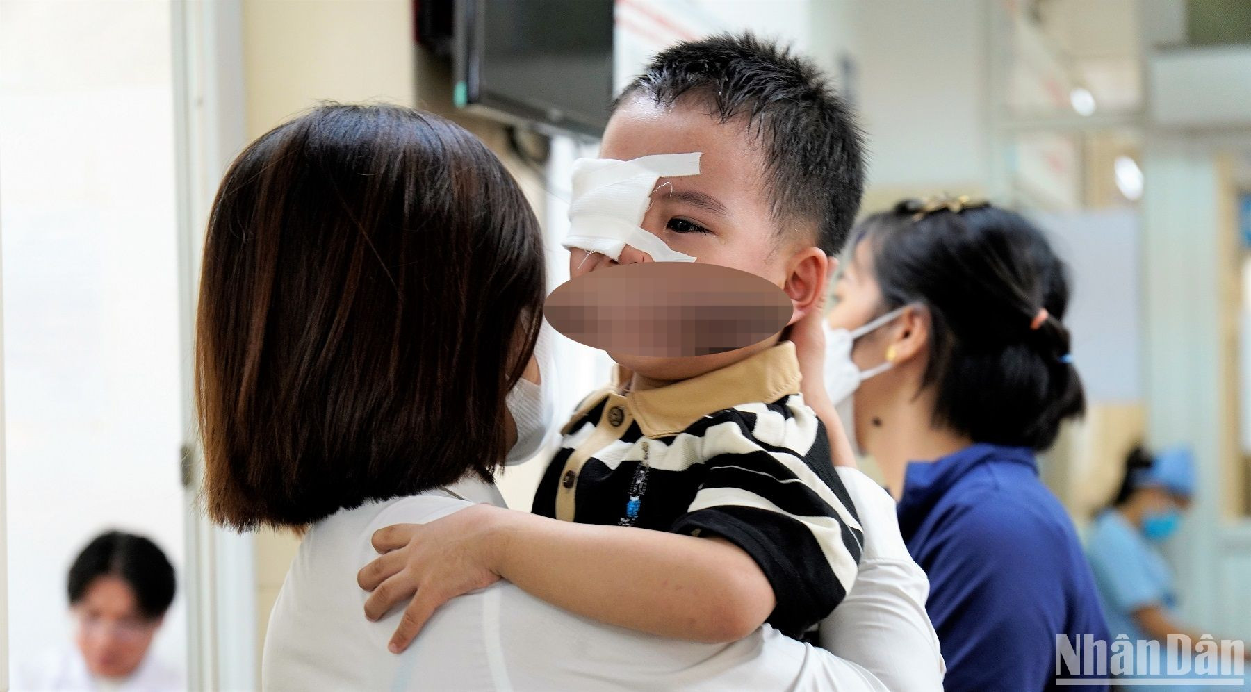 Trẻ quấy khóc sau khi được bóc giả mạc.