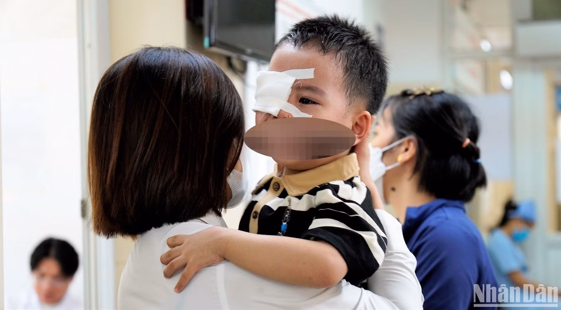 Trẻ quấy khóc sau khi được bóc giả mạc.