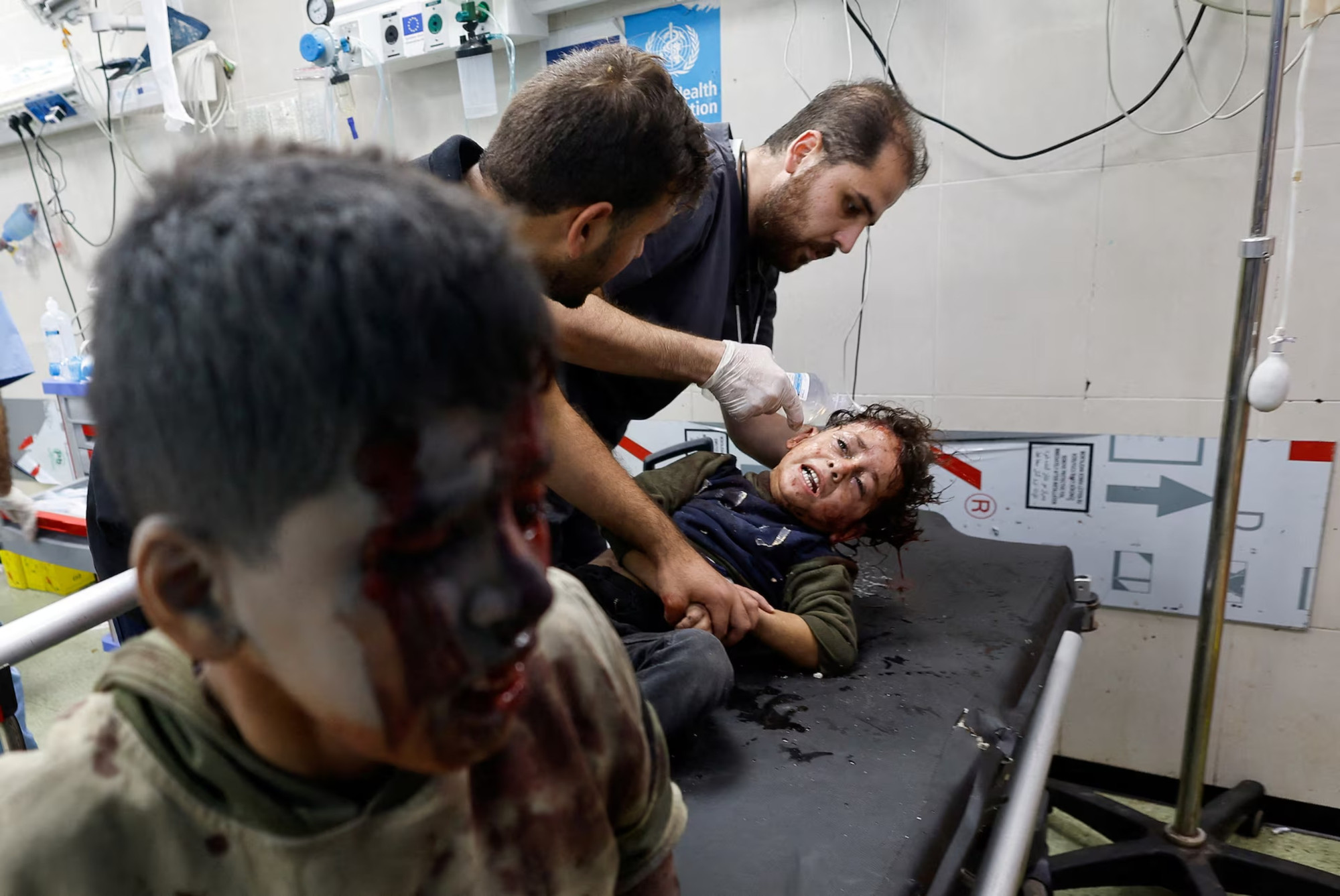 Một trẻ em Palestine bị thương trong cuộc tấn công của Israel đang được hỗ trợ điều trị tại bệnh viện Nasser, Khan Younis, phía nam dải Gaza, ngày 13/11/2023. (Ảnh: Reuters) Một trẻ em Palestine bị thương trong cuộc tấn công của Israel đang được hỗ trợ điều trị tại bệnh viện Nasser, Khan Younis, phía nam dải Gaza, ngày 13/11/2023. (Ảnh: Reuters)