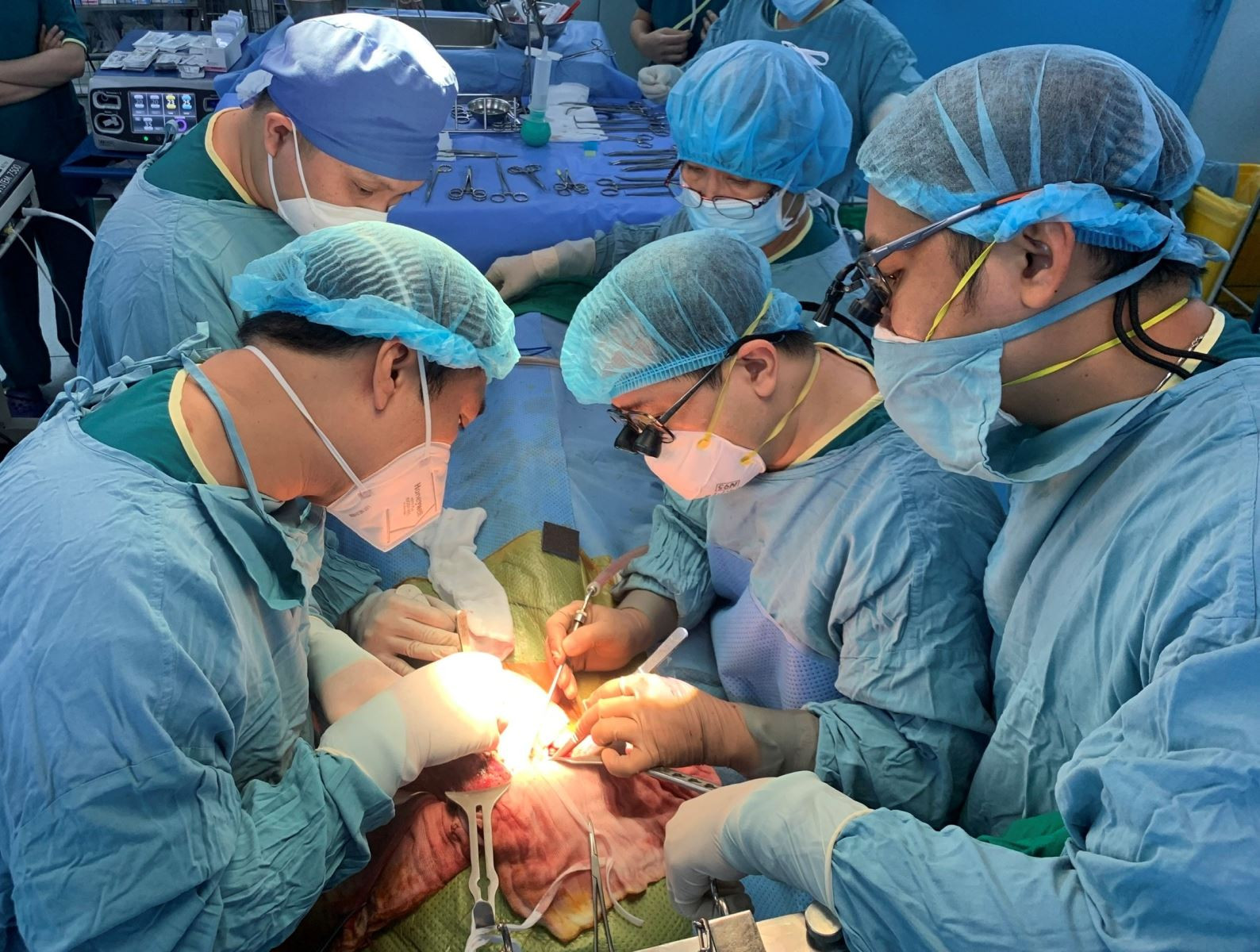 Các bác sĩ Bệnh viện Nhi Đồng 2 thực hiện ghép gan cho bệnh nhân nhi.