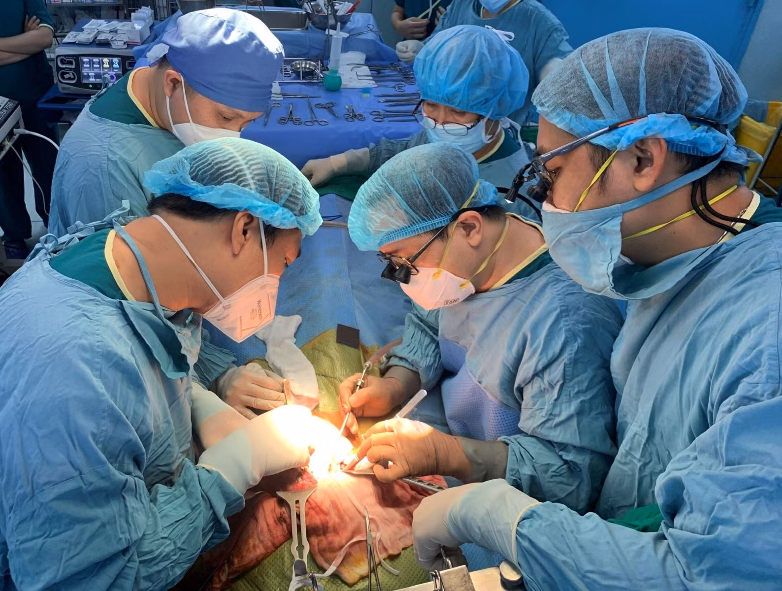 Các bác sĩ Bệnh viện Nhi Đồng 2 thực hiện ghép gan cho bệnh nhân nhi.