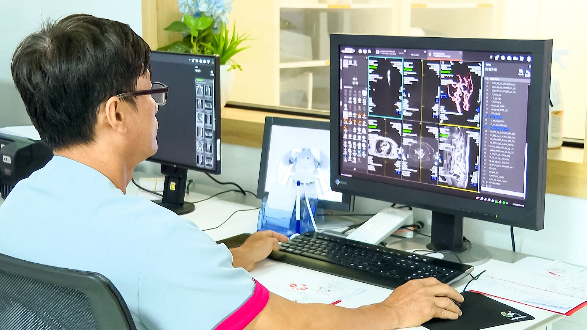 Các bác sĩ Bệnh viện. S.I.S Cần Thơ chẩn đoán hình ảnh từ công nghệ chụp CT đếm Photon (Photon Counting CT).