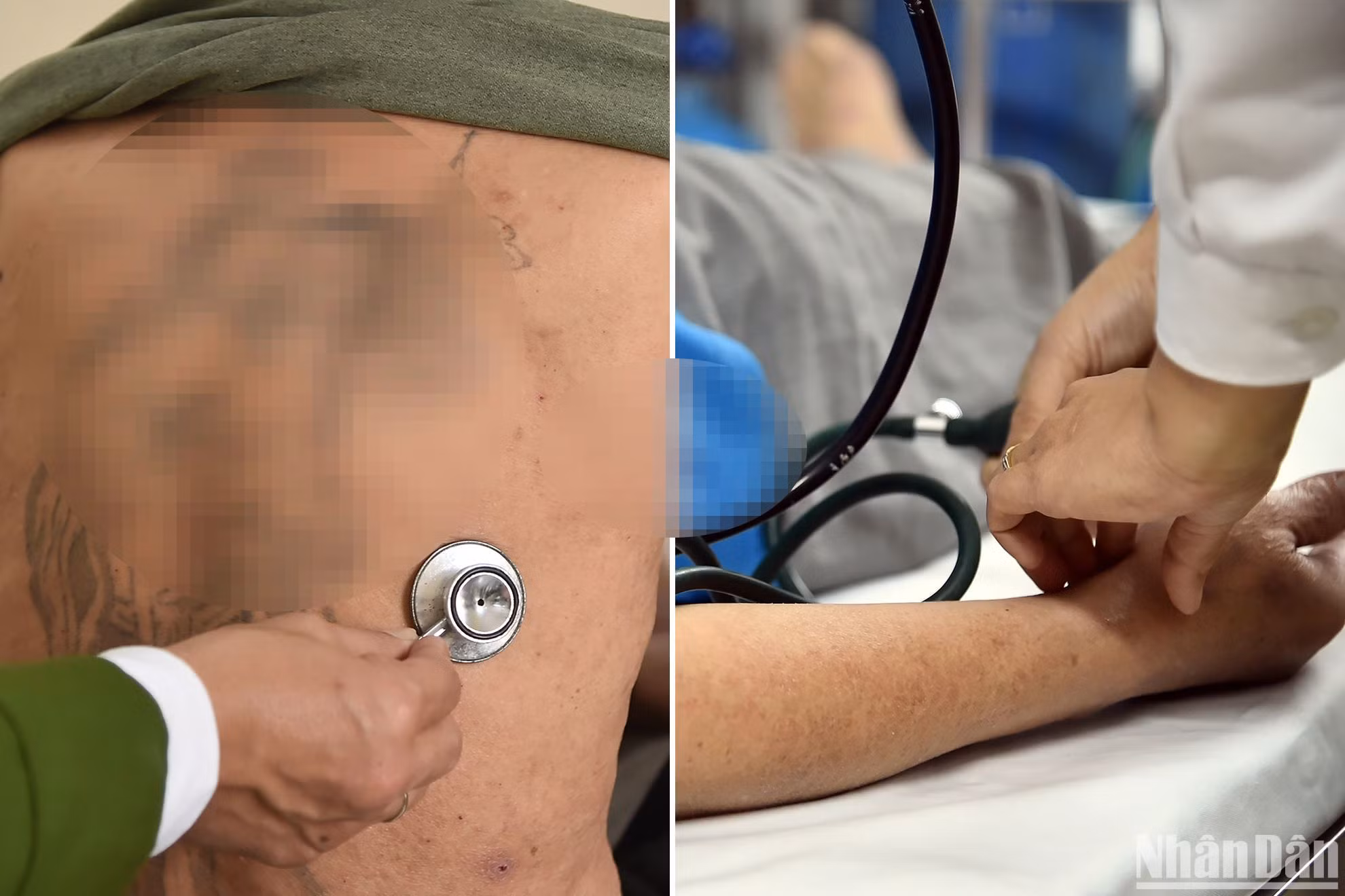 Hiện nay, Công an thành phố đã phối hợp với Bệnh viện Đa khoa Hà Đông xây dựng và đưa vào sử dụng một khu khám, điều trị bệnh dành riêng cho can phạm, phạm nhân mắc bệnh vượt quá khả năng điều trị của bệnh xá trại tạm giam. (Ảnh: Thủy Nguyên)