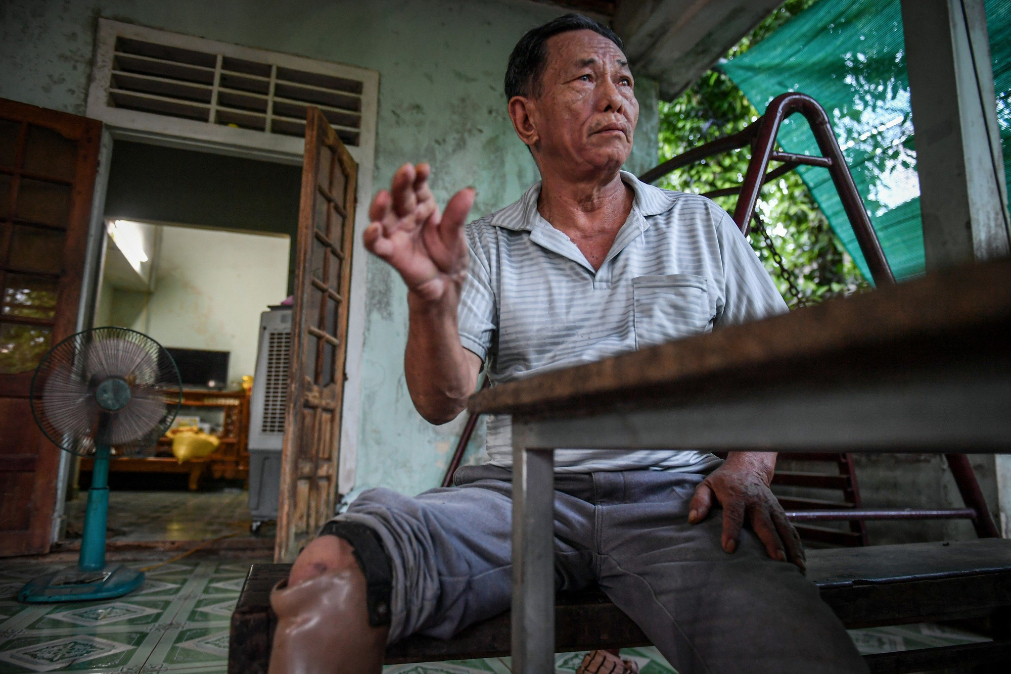 Hai lần "dính bom mìn", ông Nguyễn Diện đã mất đi chân phải, vài ngón tay và cả con mắt trái.