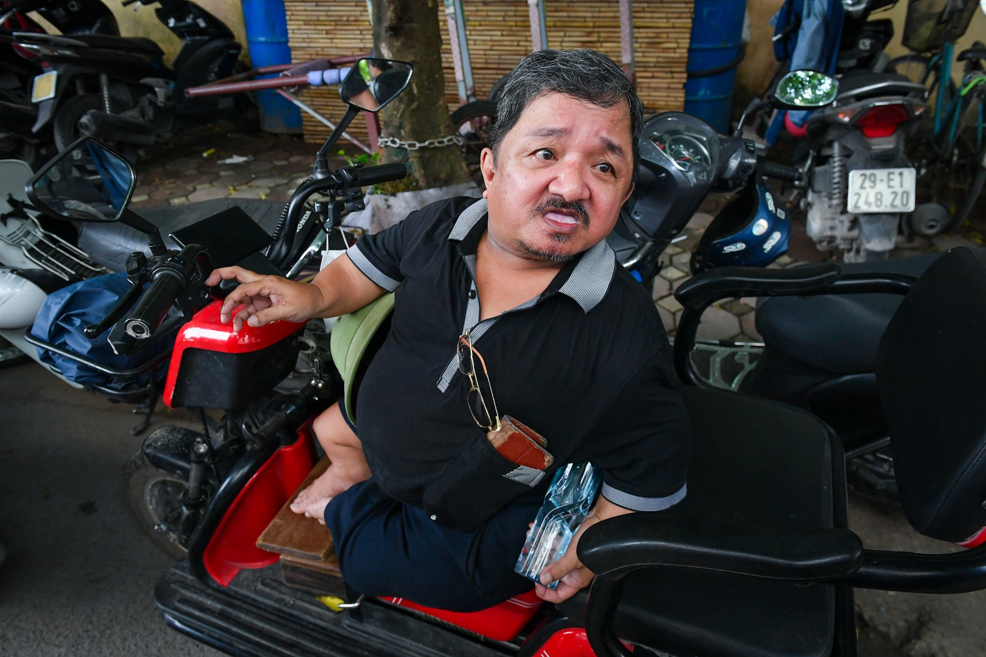 Ông Chung là một trong những người đầu tiên tại Việt Nam được chẩn đoán mắc bệnh xương thủy tinh. (Ảnh: Thành Đạt)