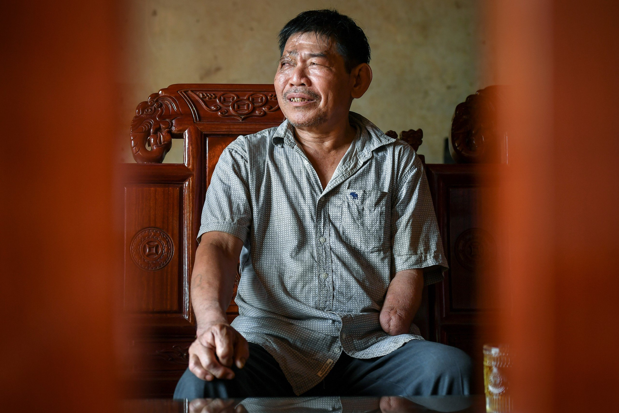 Sau nhiều năm, những nạn nhân bom, mìn, vật nổ còn sót lại như ông Sự, bà Mễ đã có thể nở nụ cười khi được trao sinh kế, trao cả niềm tin vào tương lai bình an phía trước.