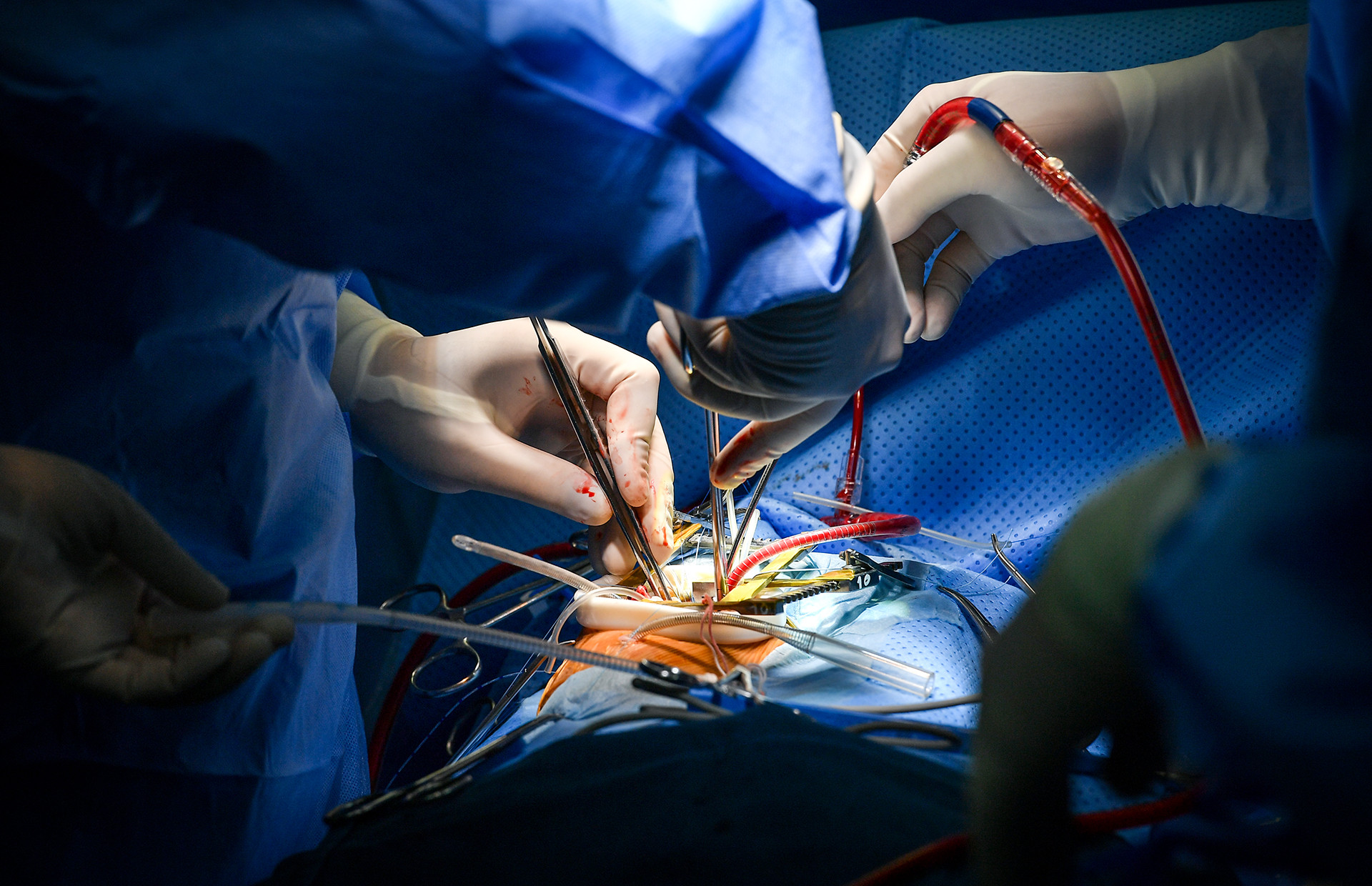 [Ảnh] Cận cảnh ca mổ thứ 700 trường hợp tim bẩm sinh với kỹ thuật ít xâm lấn ảnh 10