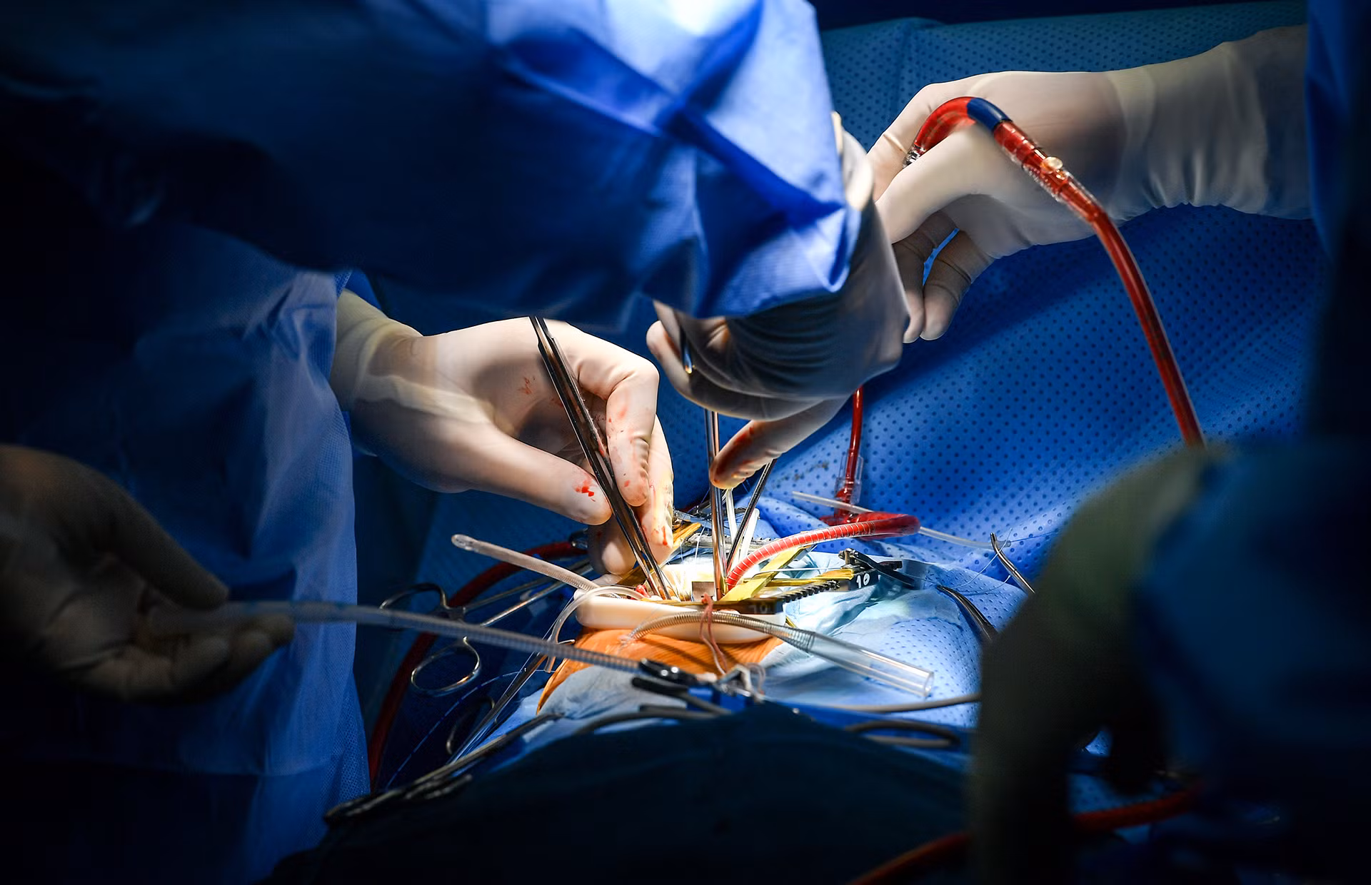 [Ảnh] Cận cảnh ca mổ thứ 700 trường hợp tim bẩm sinh với kỹ thuật ít xâm lấn ảnh 10