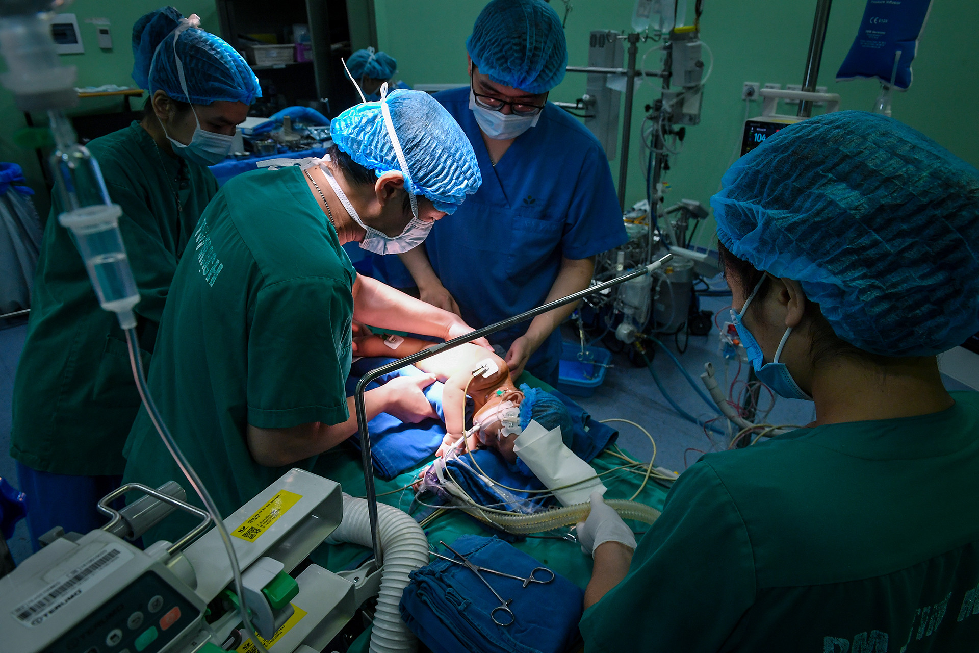 [Ảnh] Cận cảnh ca mổ thứ 700 trường hợp tim bẩm sinh với kỹ thuật ít xâm lấn ảnh 2